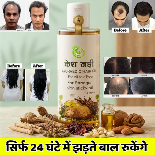 Kesh Jadi Ayurvedic Hair Oil - Ultimate Hair Growth Formula for Men & Women (Non-Sticky & Natural)